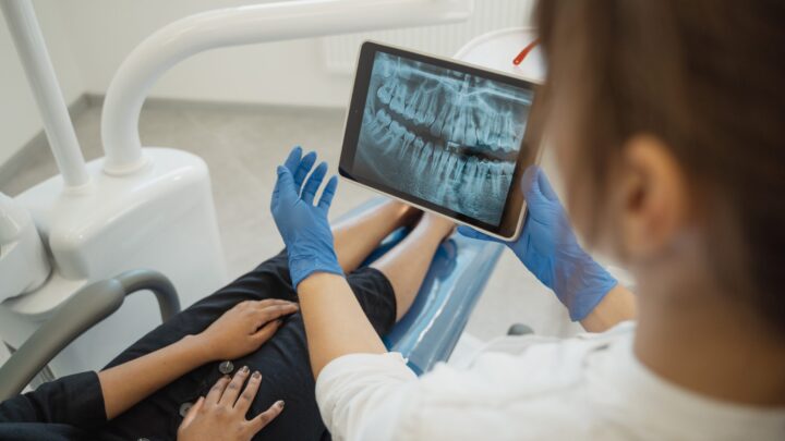Riabilitazione dentale globale in una sola seduta: tutte le cure in una sola volta