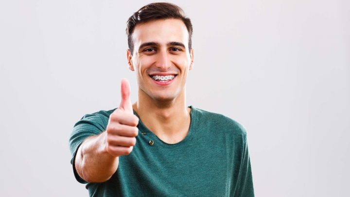 Quanto Durano gli Impianti Dentali?